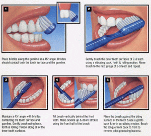 brushing