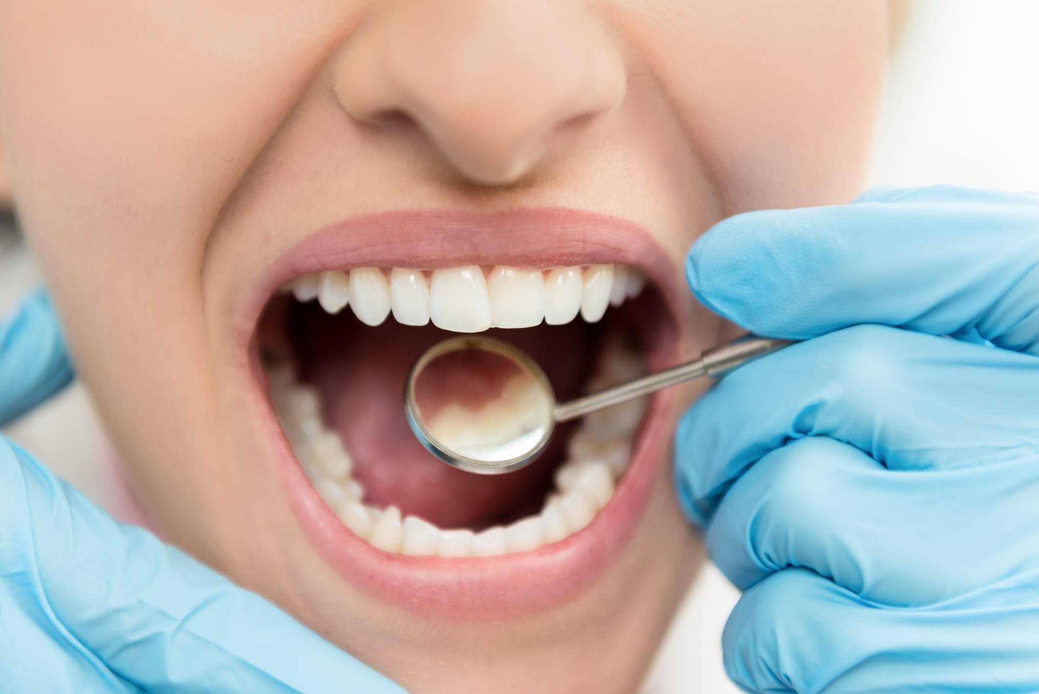 Признаки лечения зубов