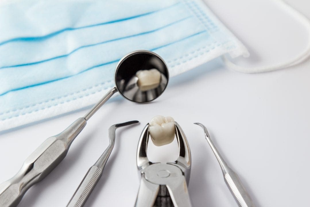 Campbelltown Teeth Removal, Tooth Removal Campbelltown