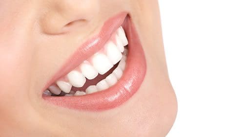 Will Teeth Whitening Harm Teeth