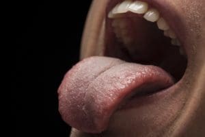 tongue health