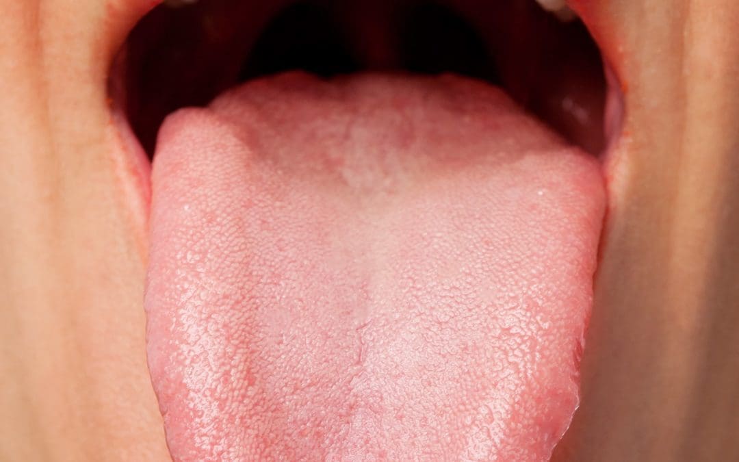 tongue health