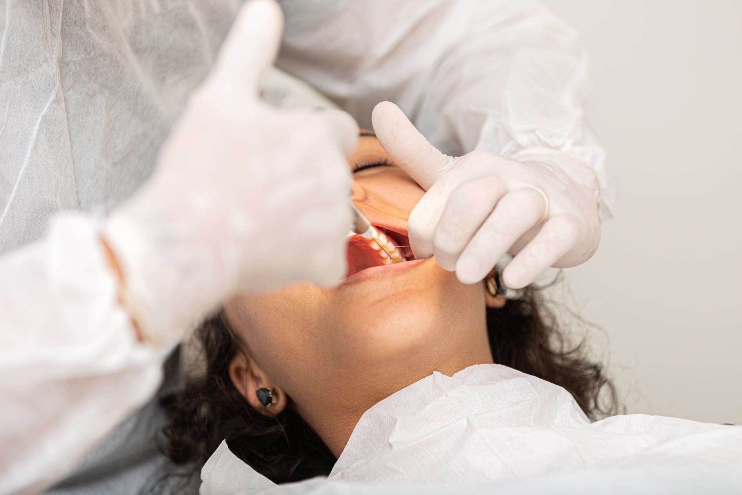 surgical wisdom tooth removal price