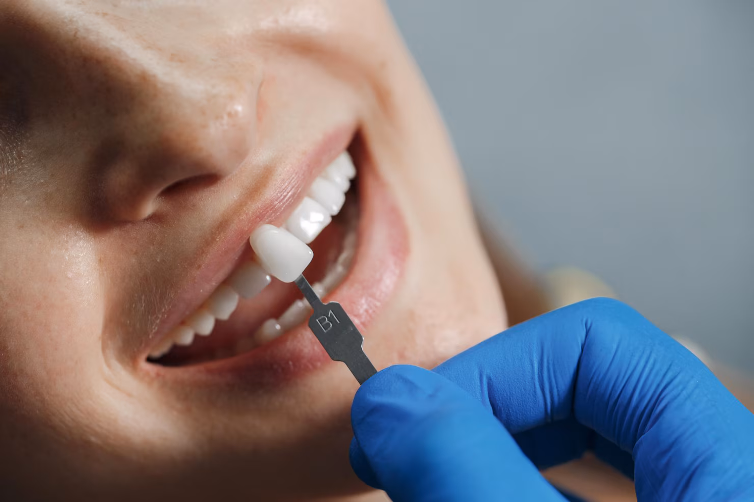 how often should you visit a dentist